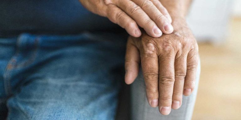 How Does an Occupational Therapist Help With Rheumatoid Arthritis?