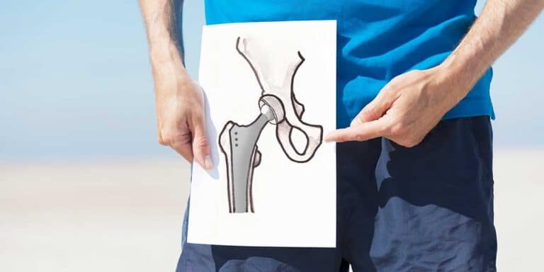 Rehabilitation for Joint Replacement